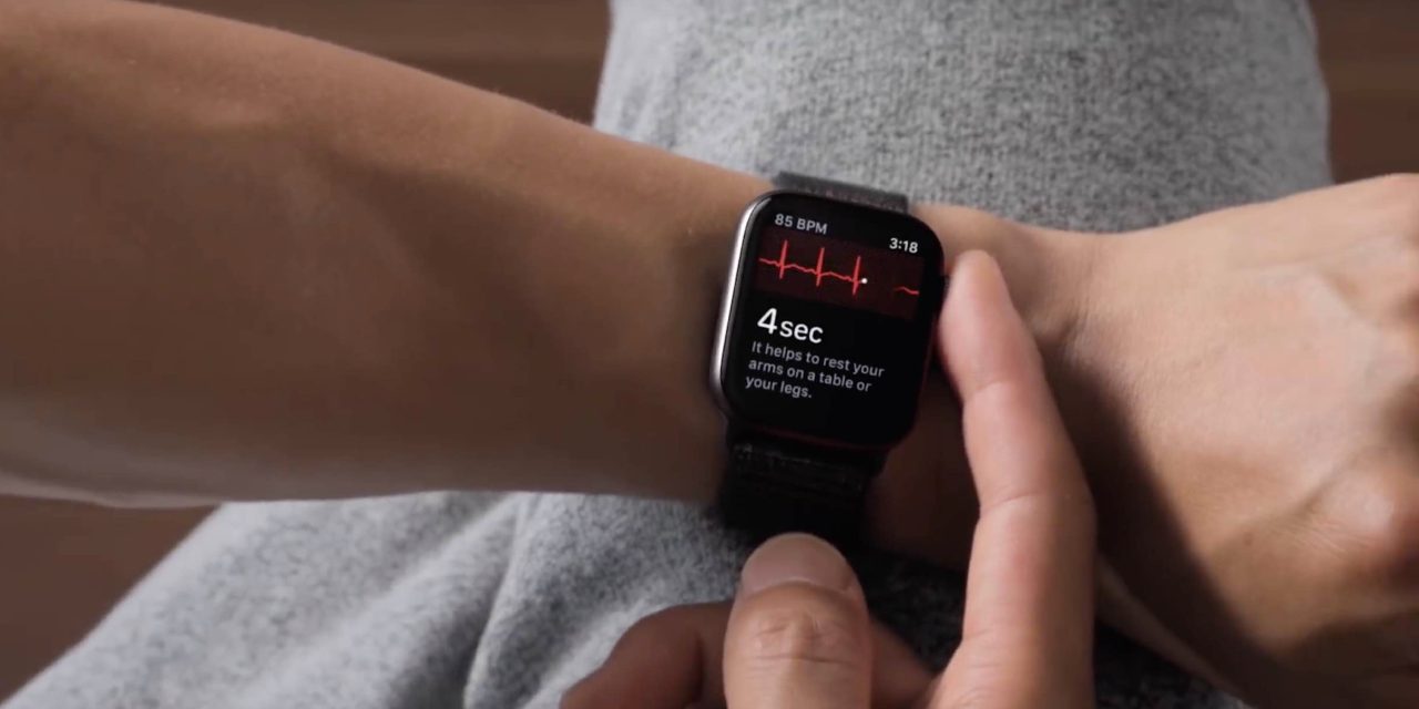 Apple Watch ECG readings
