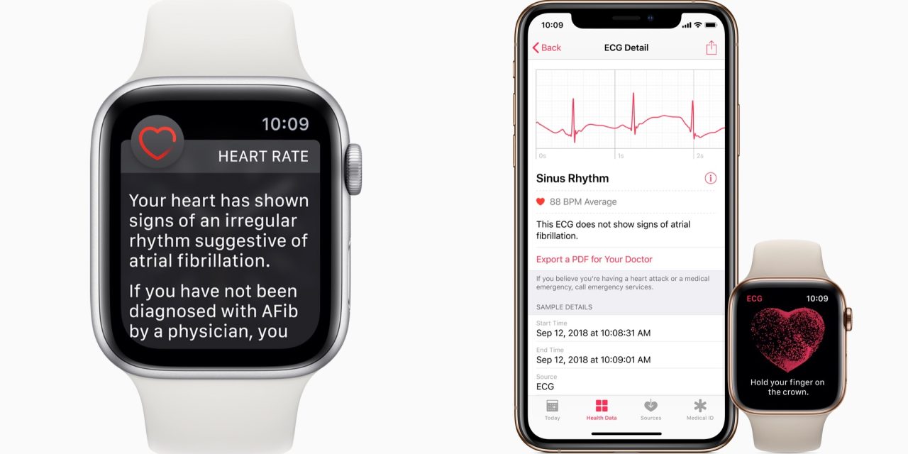 Apple Watch heart notifications