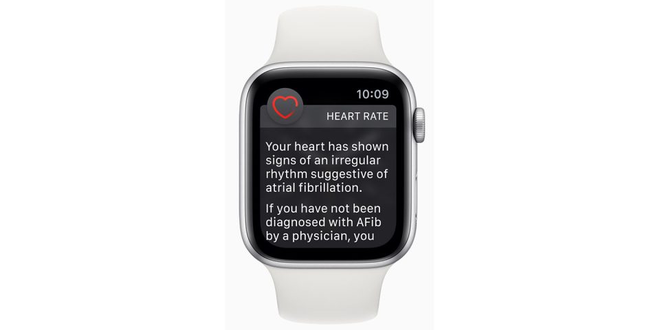 Apple Watch doesn't detect AFib above 120bpm