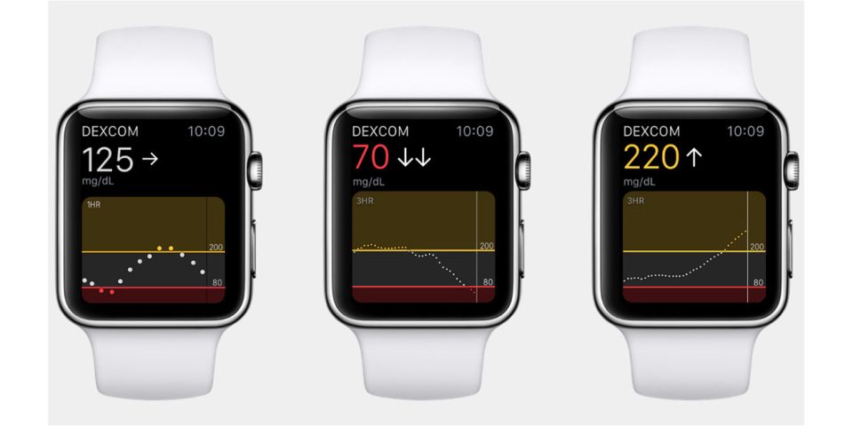 Apple Watch blood sugar measurement